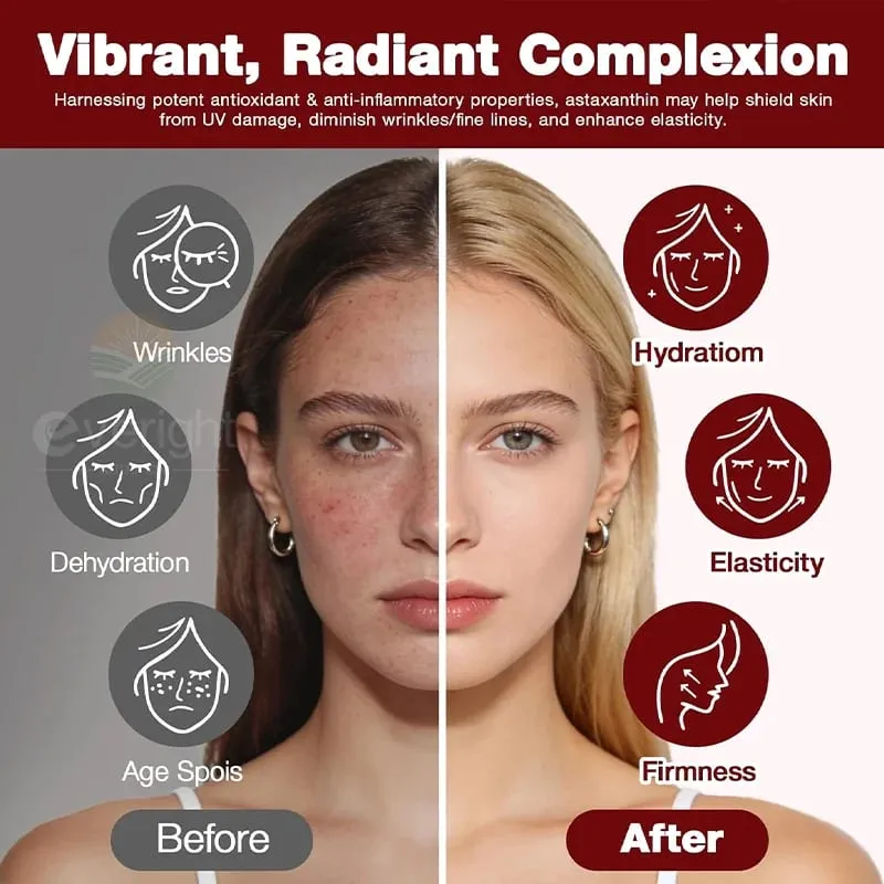 Astaxanthin 24mg – Powerful Antioxidant for Skin Eyes Immune System – 10-in-1 Formula Lycopene Grape Seed Vitamin E & Zinc