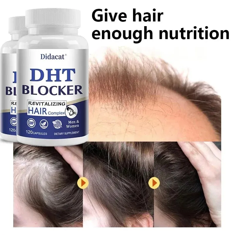 Didacat Advanced DHT Blocker Hair Growth Supplement for Hereditary Thinning Hair - for Men and Women Hair Loss — image 4